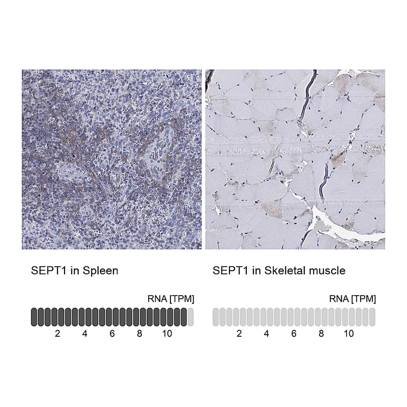 Atlas Antibodies Anti-SEPT1 Antibody
