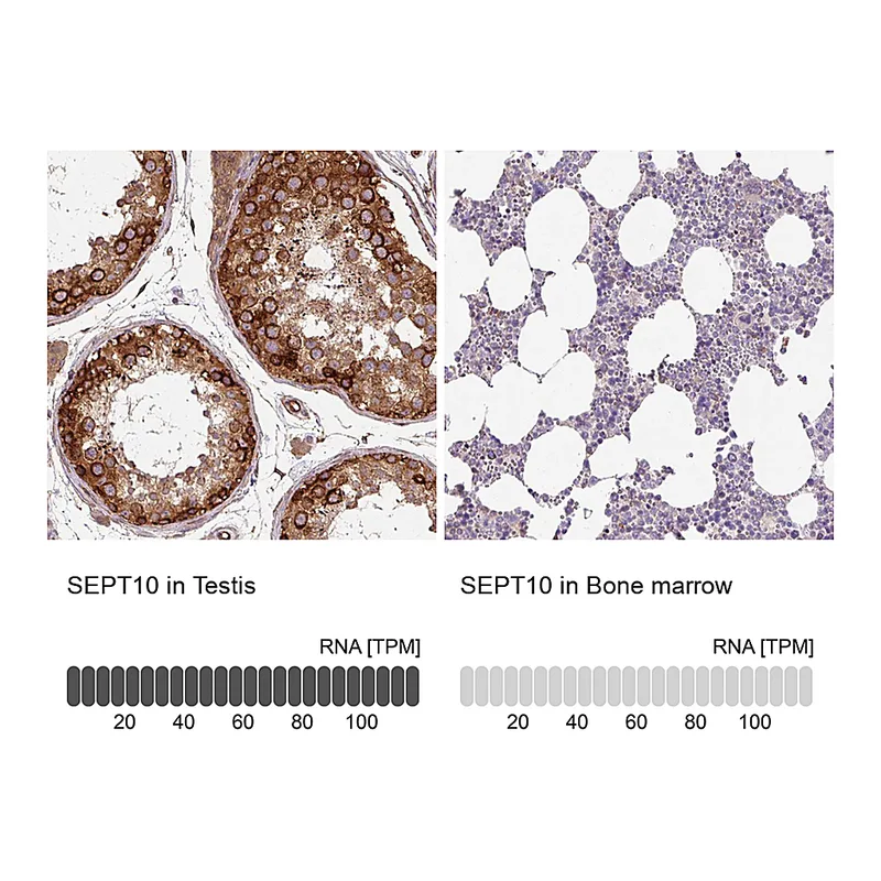 Atlas Antibodies Anti-SEPT10 Antibody