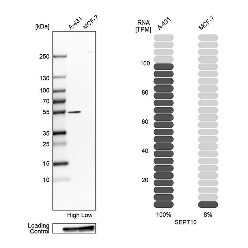 Atlas Antibodies Anti-SEPT10 Antibody