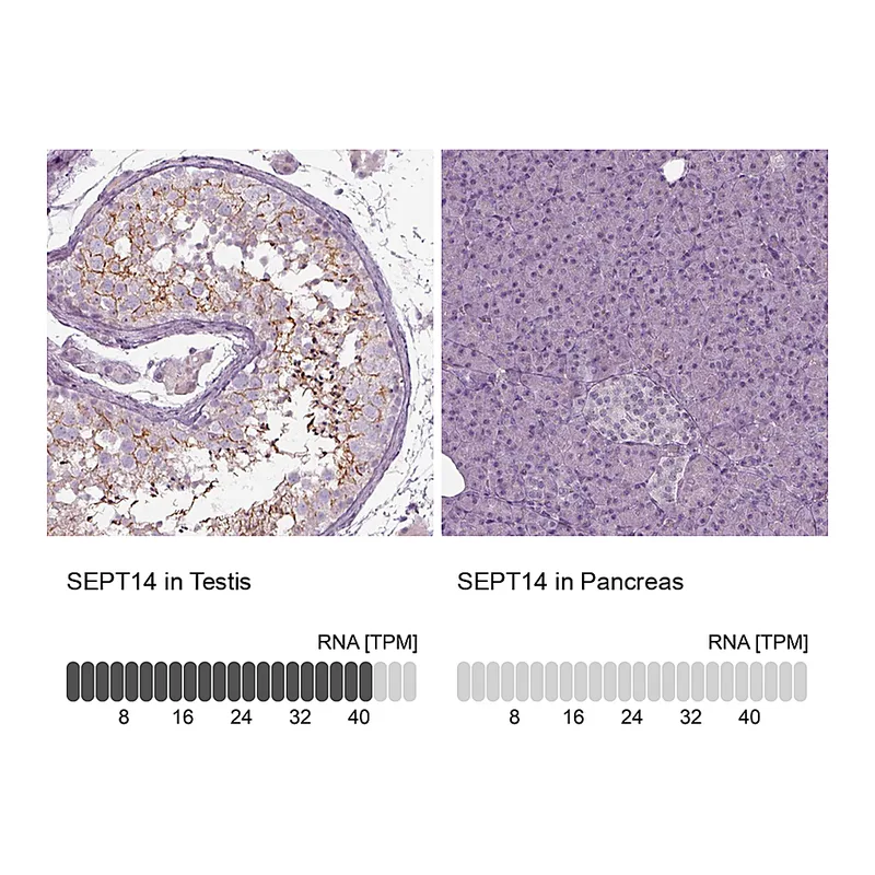 Atlas Antibodies Anti-SEPT14 Antibody