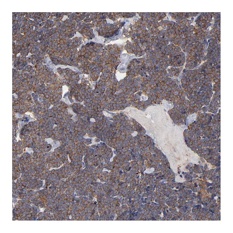 Atlas Antibodies Anti-SEPT6 Antibody