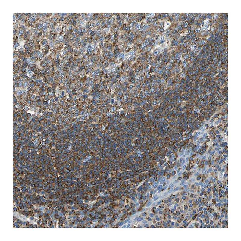 Atlas Antibodies Anti-SEPT6 Antibody