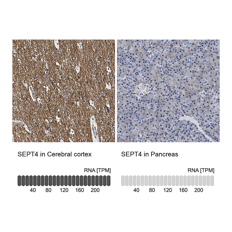 Atlas Antibodies Anti-SEPT4 Antibody