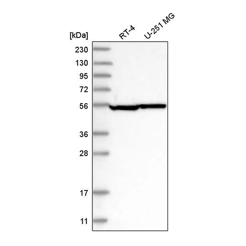Atlas Antibodies Anti-SEPT8 Antibody