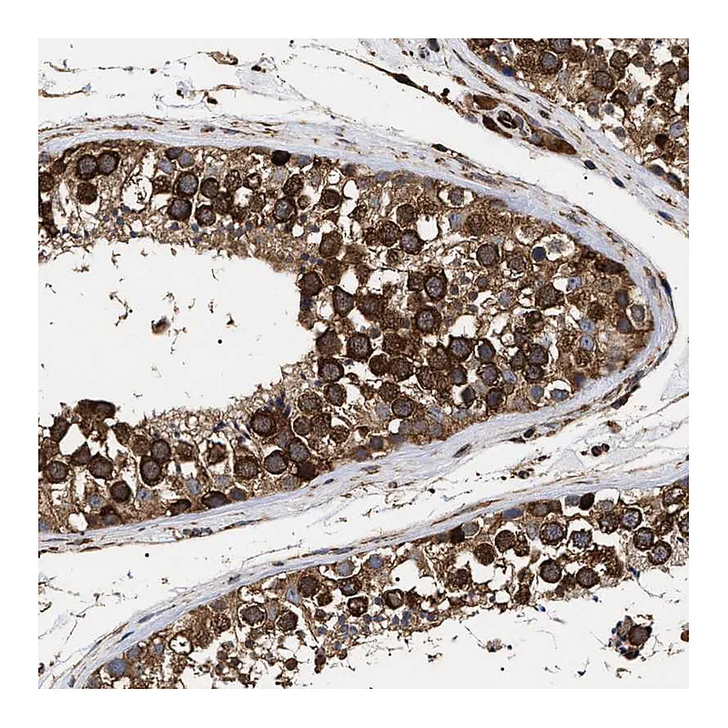 Atlas Antibodies Anti-SERBP1 Antibody