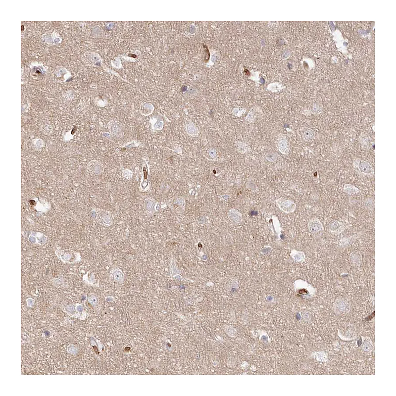 Atlas Antibodies Anti-SERINC1 Antibody