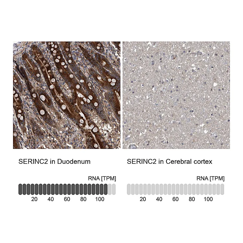 Atlas Antibodies Anti-SERINC2 Antibody