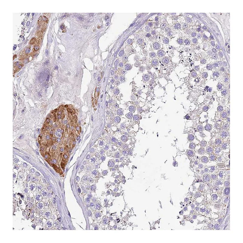 Atlas Antibodies Anti-SERINC3 Antibody