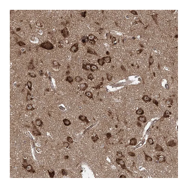 Atlas Antibodies Anti-SERINC1 Antibody