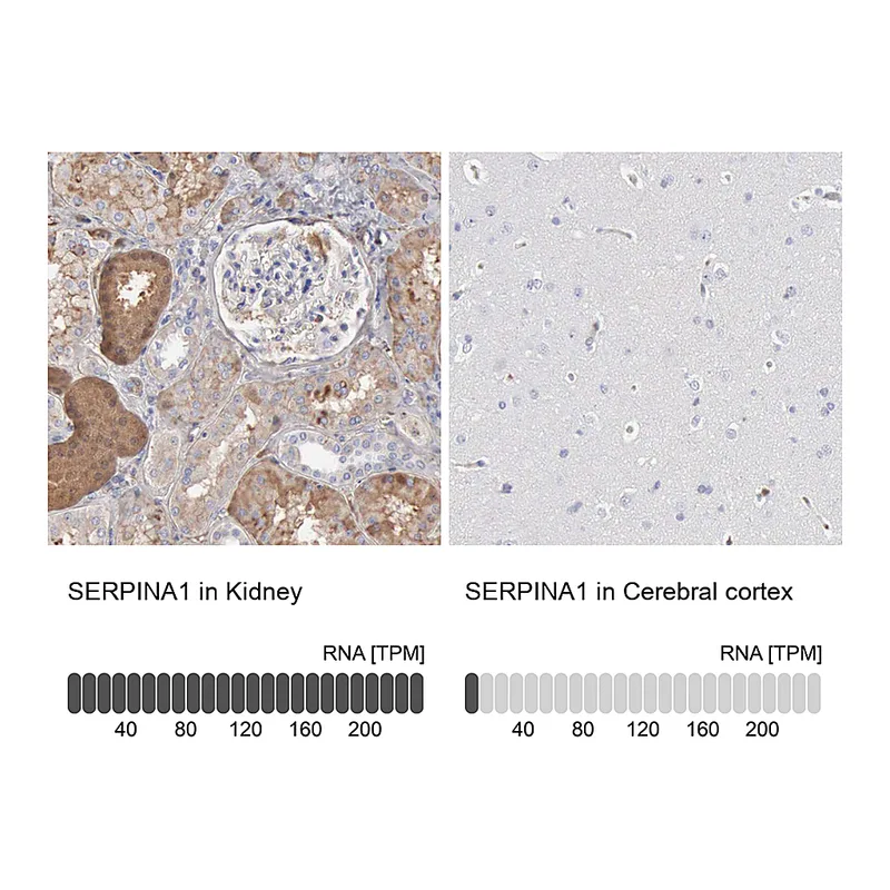Atlas Antibodies Anti-SERPINA1 Antibody