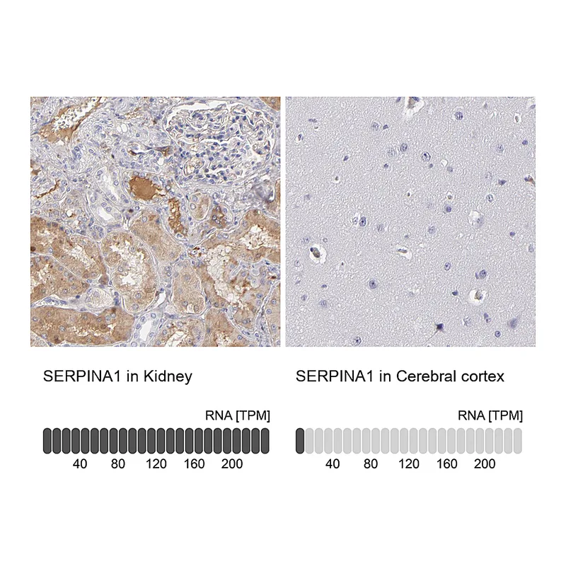 Atlas Antibodies Anti-SERPINA1 Antibody