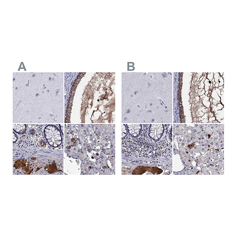 Atlas Antibodies Anti-SERPINA3 Antibody