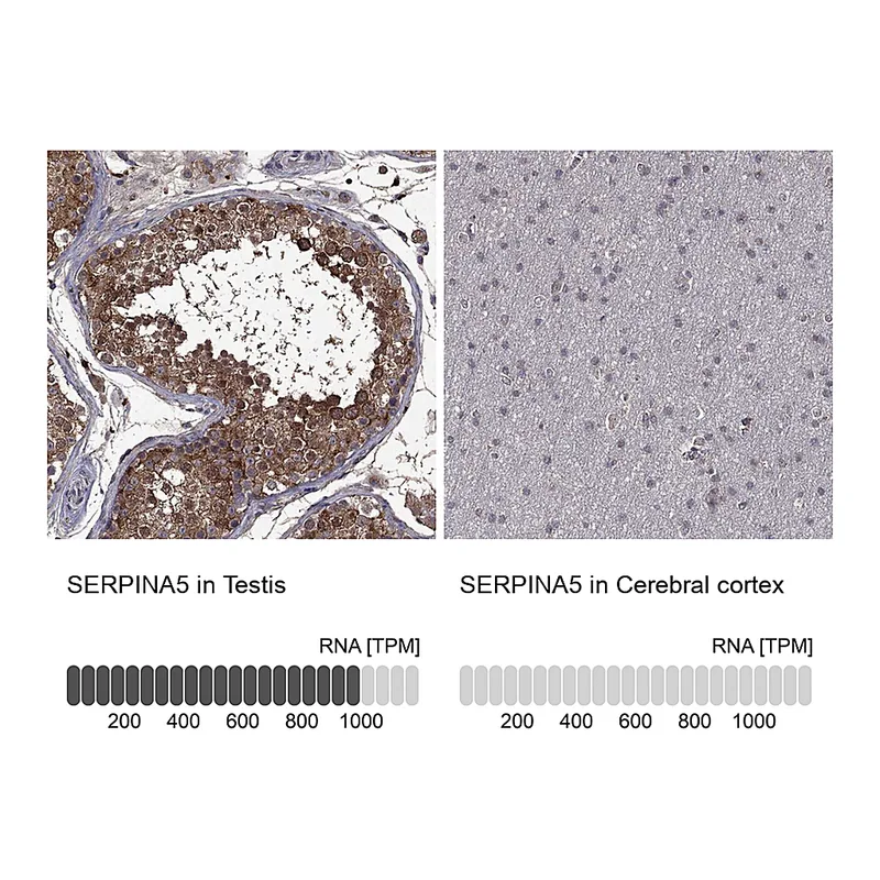 Atlas Antibodies Anti-SERPINA5 Antibody