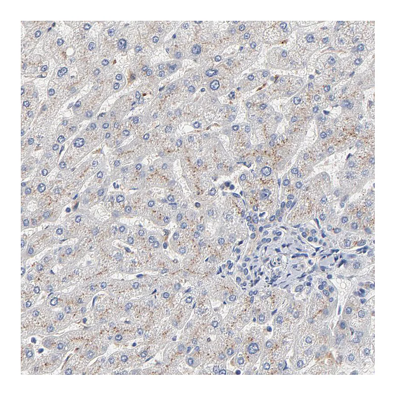 Atlas Antibodies Anti-SERPINA4 Antibody