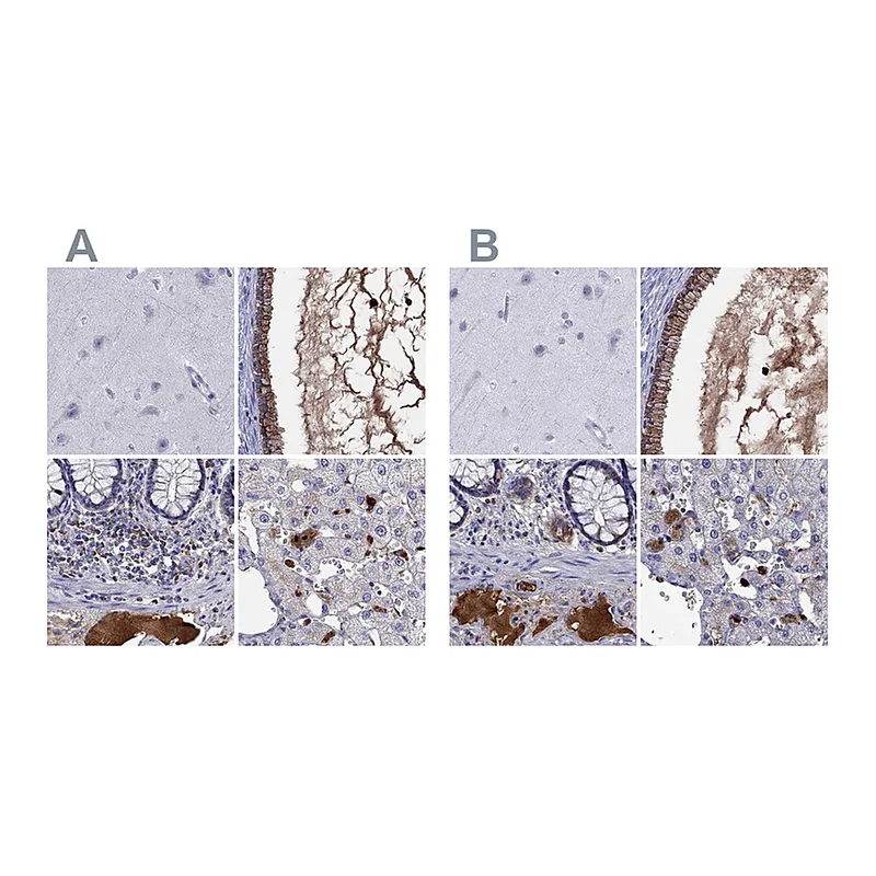 Atlas Antibodies Anti-SERPINA3 Antibody