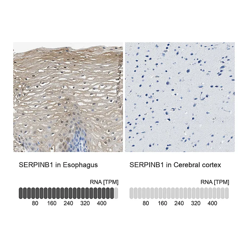Atlas Antibodies Anti-SERPINB1 Antibody