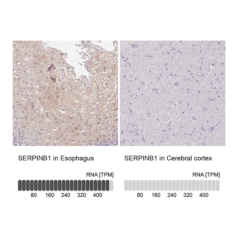 Atlas Antibodies Anti-SERPINB1 Antibody