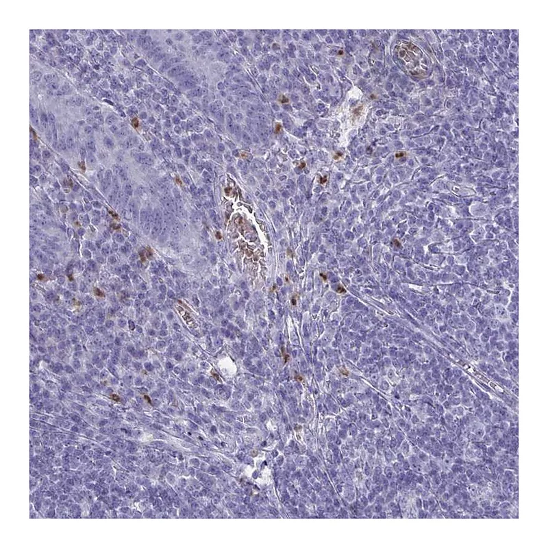 Atlas Antibodies Anti-SERPINB10 Antibody