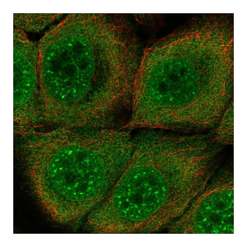 Atlas Antibodies Anti-SERPINB13 Antibody