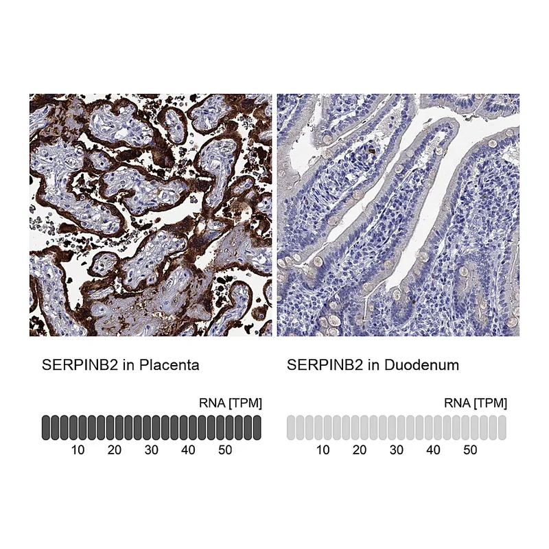 Atlas Antibodies Anti-SERPINB2 Antibody