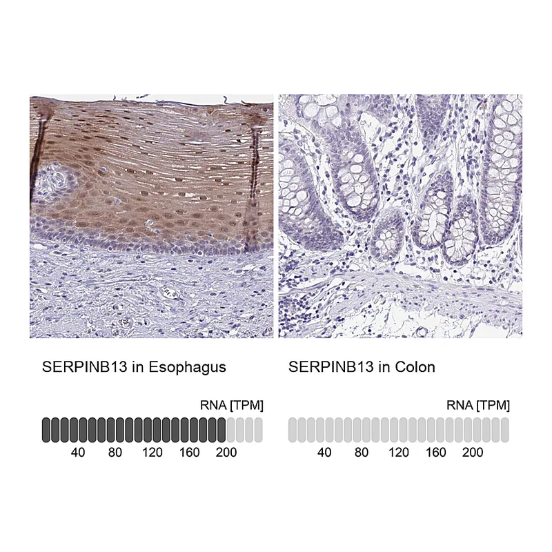Atlas Antibodies Anti-SERPINB13 Antibody