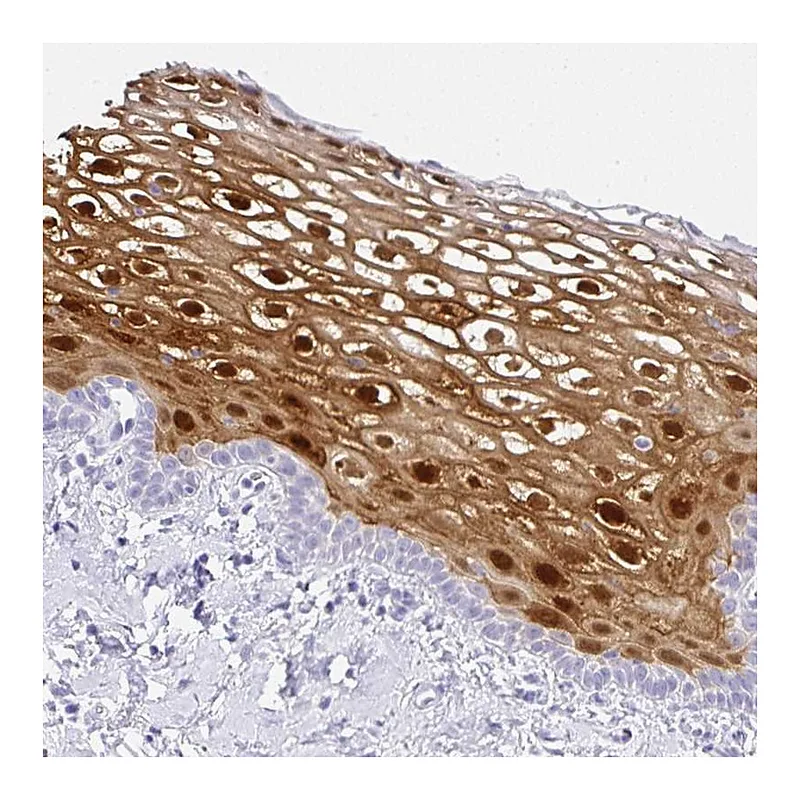 Atlas Antibodies Anti-SERPINB3 Antibody