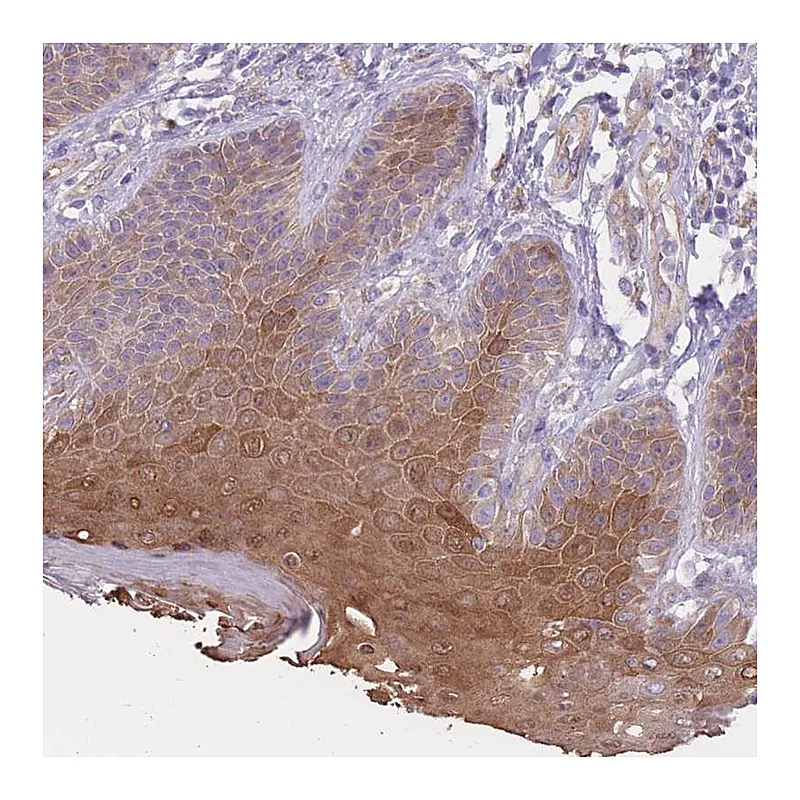 Atlas Antibodies Anti-SERPINB4 Antibody