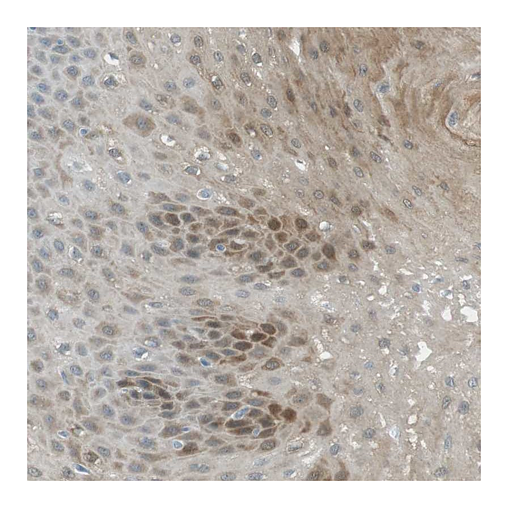 Atlas Antibodies Anti-SERPINB2 Antibody