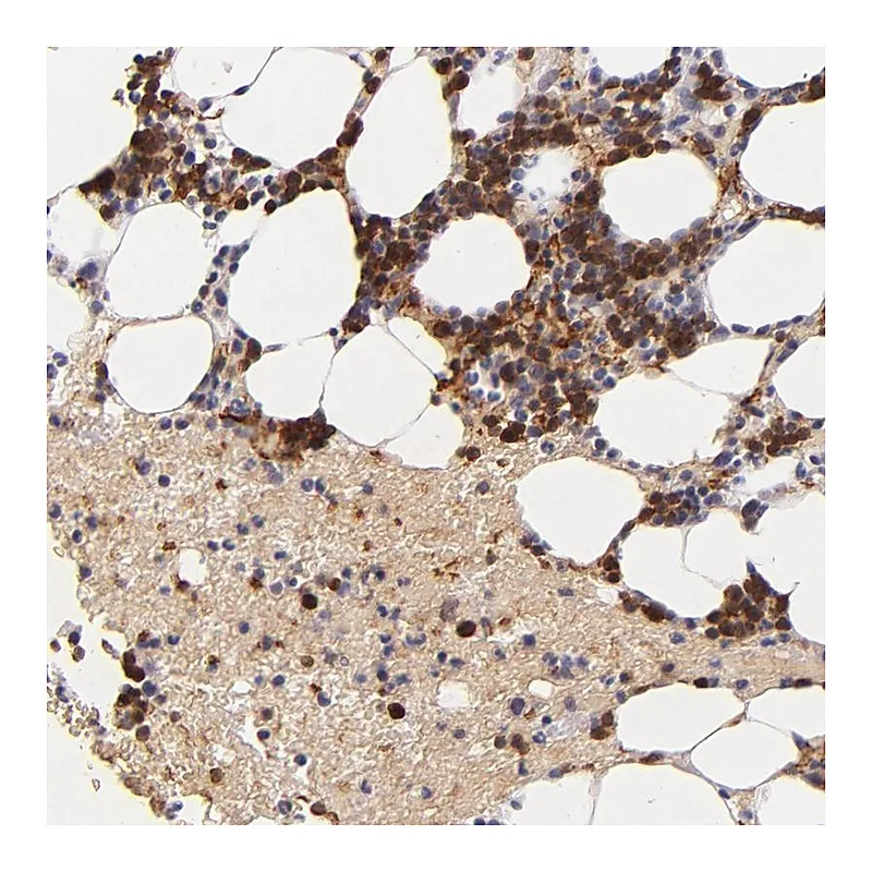 Atlas Antibodies Anti-SERPINC1 Antibody