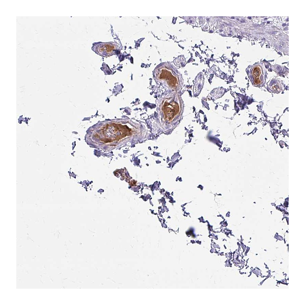 Atlas Antibodies Anti-SERPIND1 Antibody