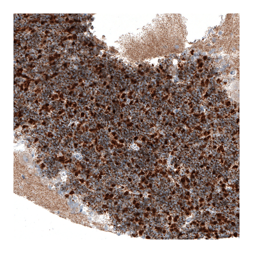 Atlas Antibodies Anti-SERPINE3 Antibody
