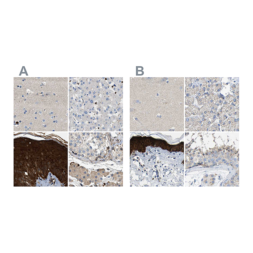 Atlas Antibodies Anti-SERPINB5 Antibody
