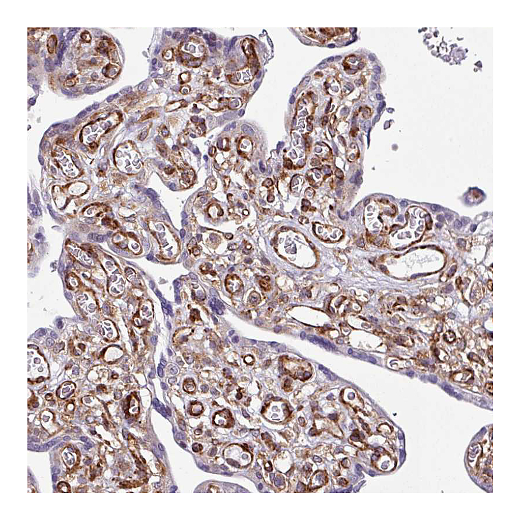 Atlas Antibodies Anti-SERPINE1 Antibody