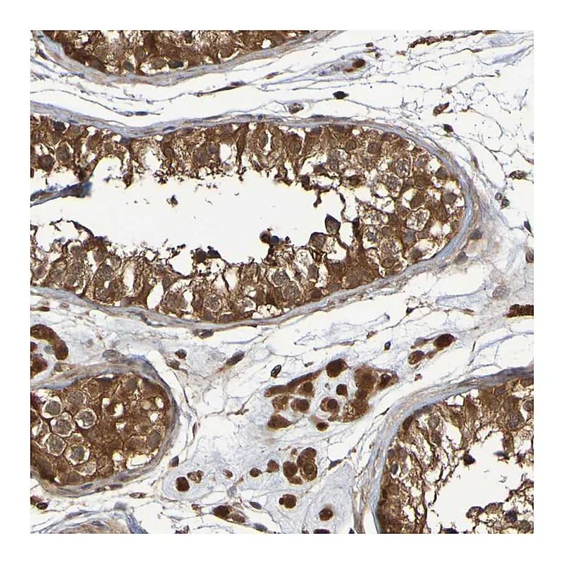 Atlas Antibodies Anti-SERPINB6 Antibody