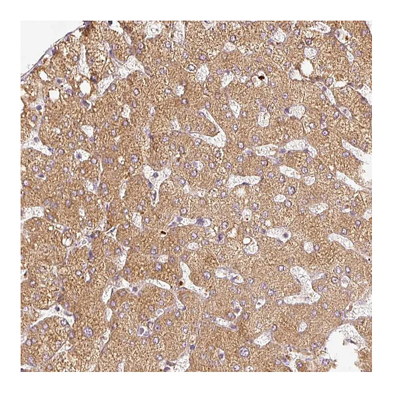 Atlas Antibodies Anti-SERPING1 Antibody