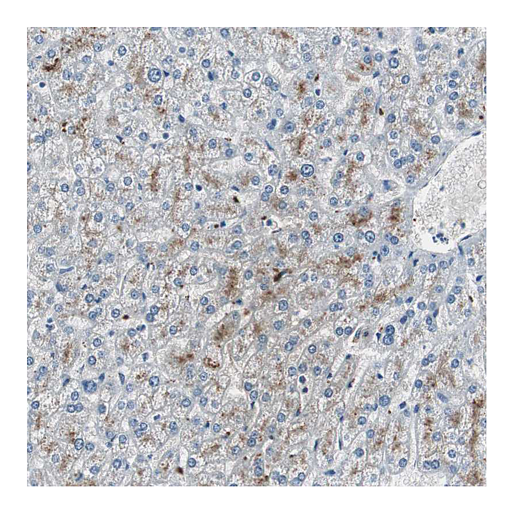 Atlas Antibodies Anti-SERPINF1 Antibody