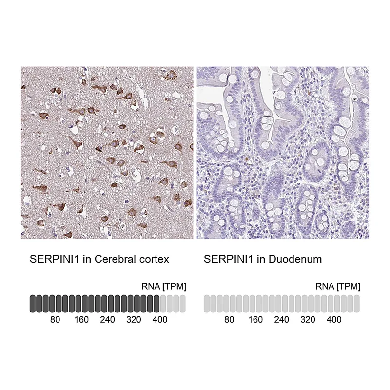 Atlas Antibodies Anti-SERPINI1 Antibody