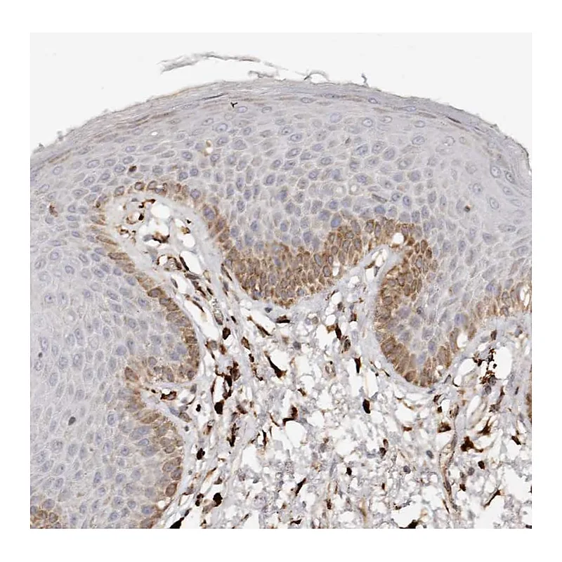 Atlas Antibodies Anti-SERPINH1 Antibody