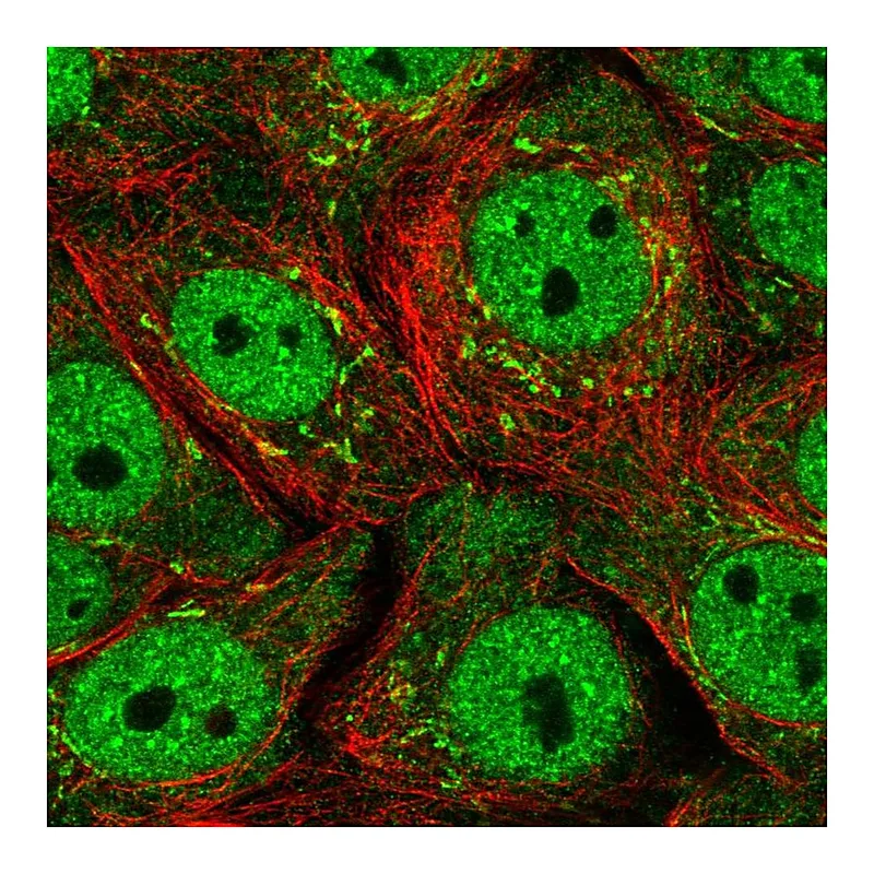 Atlas Antibodies Anti-SERTAD1 Antibody