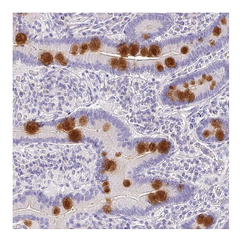 Atlas Antibodies Anti-SERPINE3 Antibody