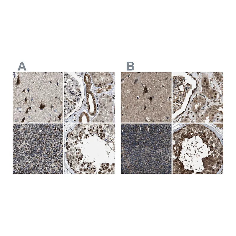 Atlas Antibodies Anti-SERTAD2 Antibody