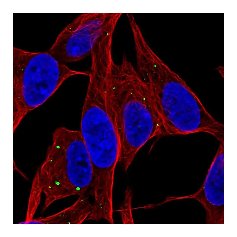 Atlas Antibodies Anti-SERTM1 Antibody