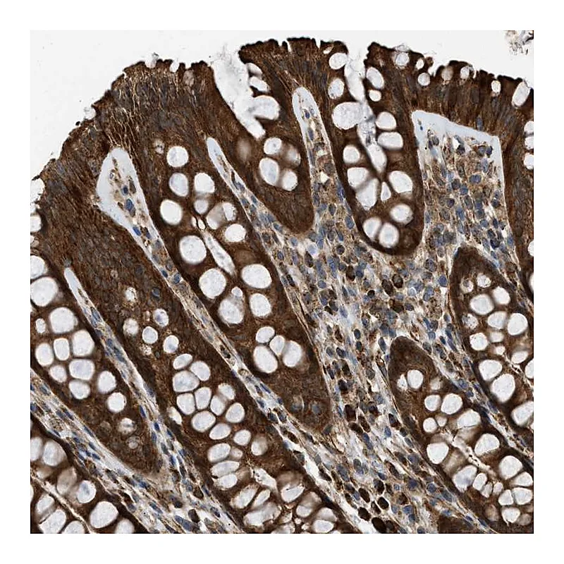 Atlas Antibodies Anti-SESN2 Antibody