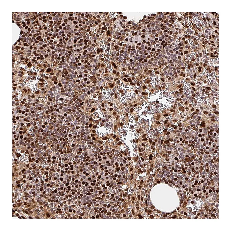 Atlas Antibodies Anti-SET Antibody