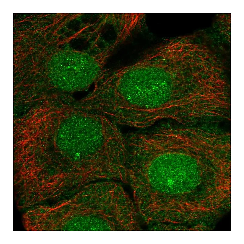 Atlas Antibodies Anti-SETBP1 Antibody
