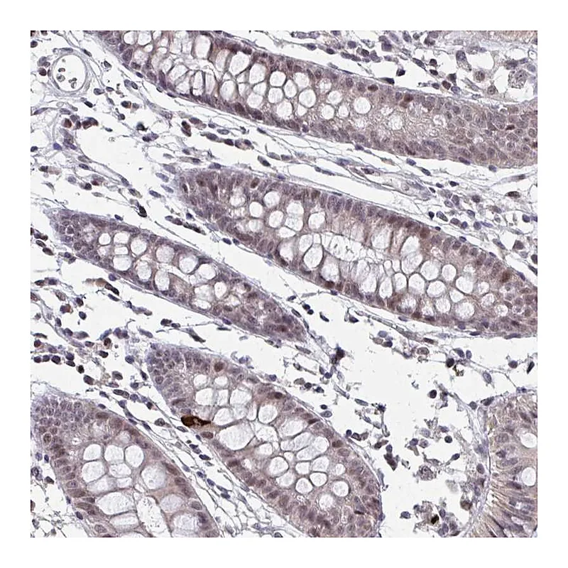 Atlas Antibodies Anti-SETBP1 Antibody