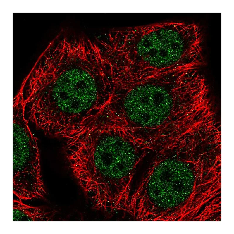 Atlas Antibodies Anti-SETD1B Antibody
