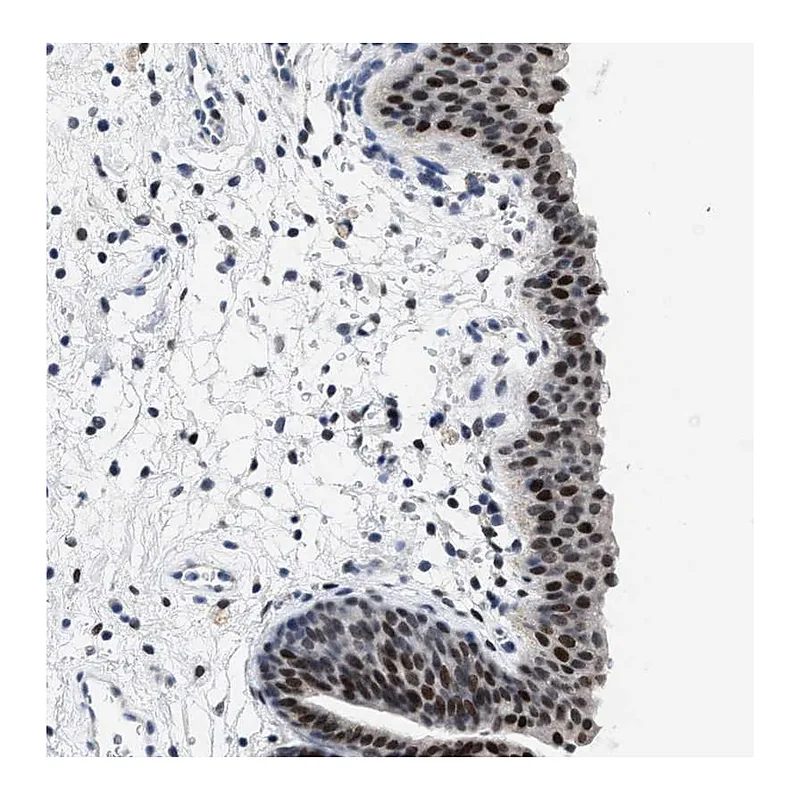 Atlas Antibodies Anti-SETD1B Antibody