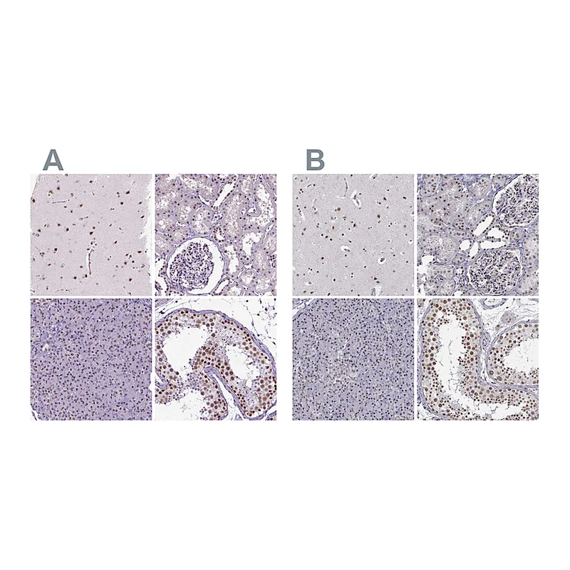 Atlas Antibodies Anti-SETD1A Antibody