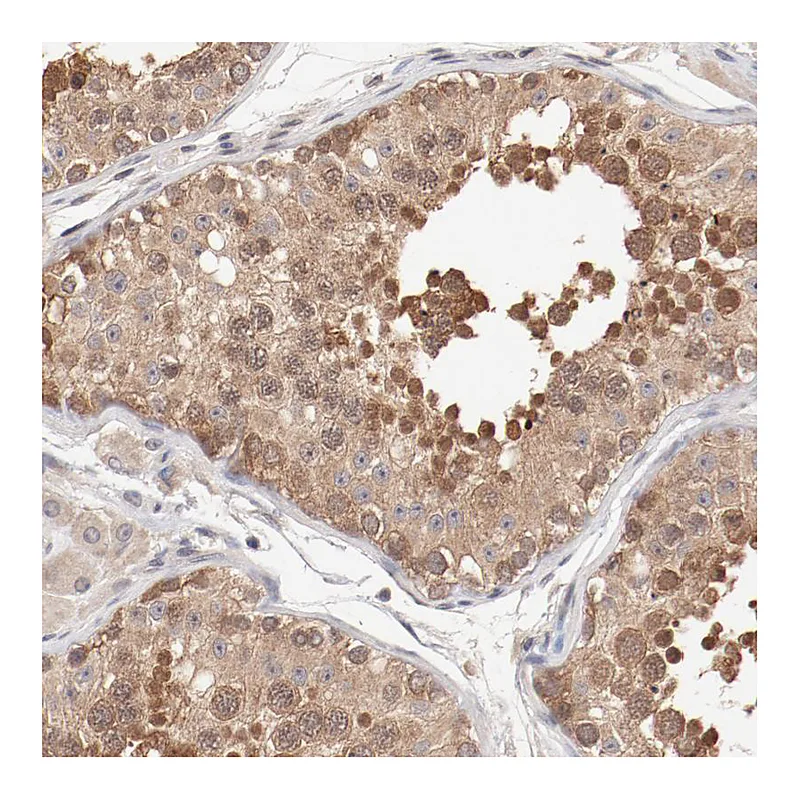 Atlas Antibodies Anti-SETD3 Antibody
